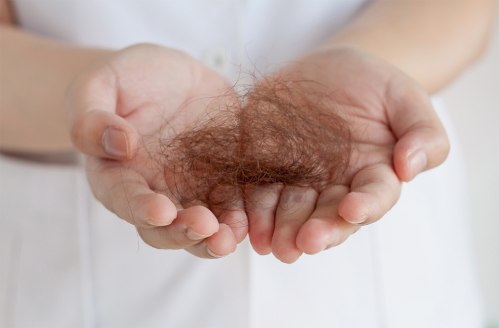 Analysis of the Causes of Hair Loss and Hair Care Trends During Seasonal Changes: How Should Brands Develop Products to Prevent Hair Loss?